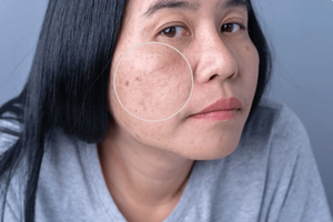 CeraVe SA Smoothing Cleanser bottle with smooth, glowing skin texture behind.